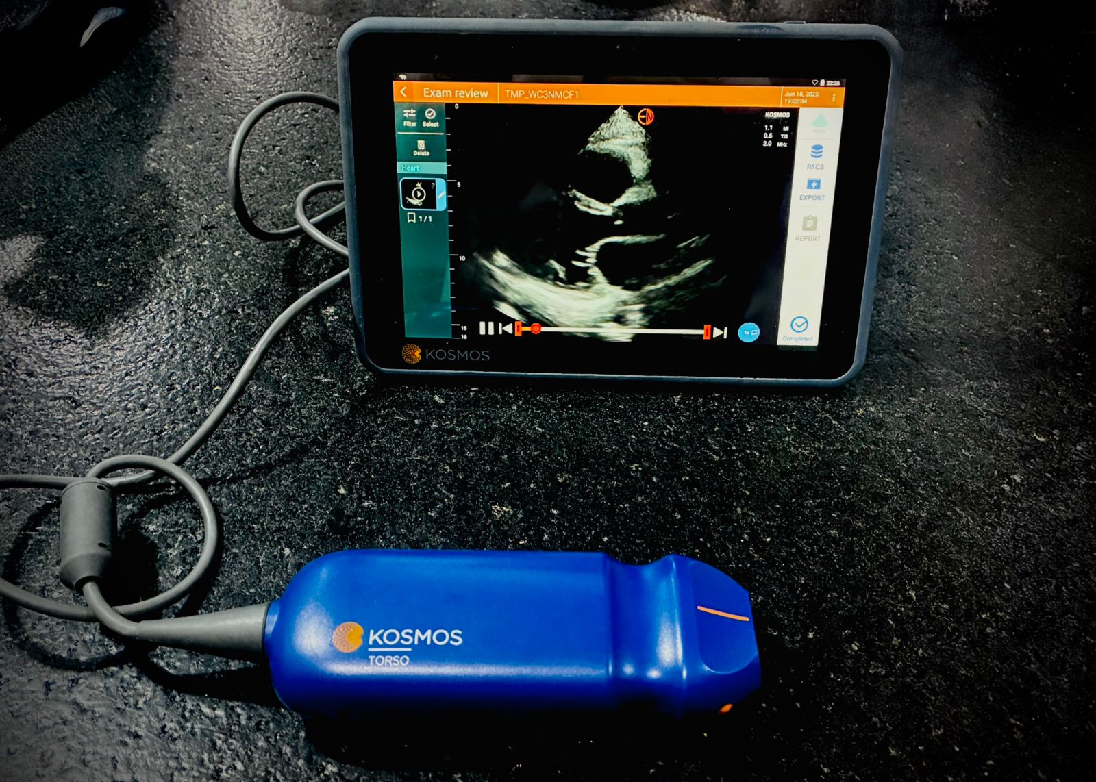 Ecocardiograma a Domicilio