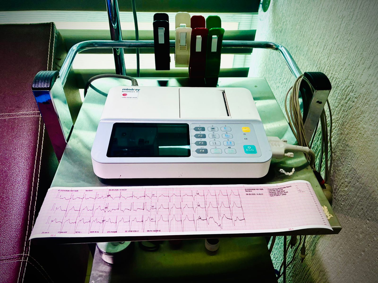 Electrocardiograma